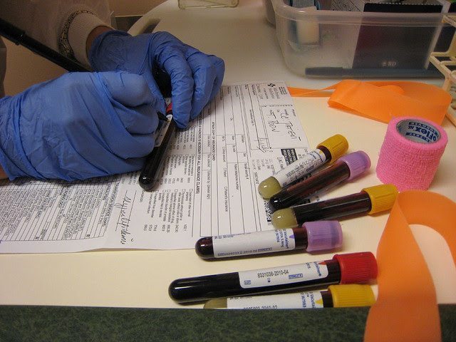 new jersey criminal defense attorney - Does Probation Require a Drug Test in Atlantic City